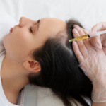 PRP Hair Treatment: How It Works and What to Expect