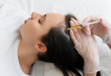 PRP Hair Treatment: How It Works and What to Expect