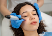 Rejuvenate Your Skin with Microneedling with PRP Near Me