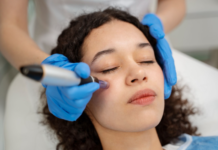 Top Benefits of Microneedling Treatment for Skin Rejuvenation