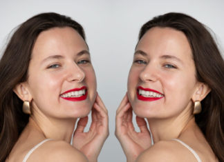 How Many Sculptra Treatments Are Usually Needed for Visible Results?