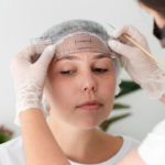 Top‑Rated Microneedling Services Near Me: What to Expect and How to Choose