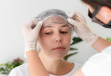 Top‑Rated Microneedling Services Near Me: What to Expect and How to Choose