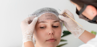 Top‑Rated Microneedling Services Near Me: What to Expect and How to Choose