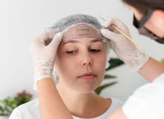 Top‑Rated Microneedling Services Near Me: What to Expect and How to Choose