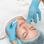 Top 4 Treatments to Achieve Glowing and Youthful Skin