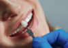 Radiant Confidence: Top Tips to Enhance Your Beautiful Smile