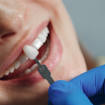 Radiant Confidence: Top Tips to Enhance Your Beautiful Smile