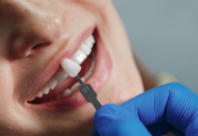 Radiant Confidence: Top Tips to Enhance Your Beautiful Smile