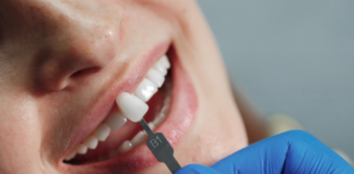 Radiant Confidence: Top Tips to Enhance Your Beautiful Smile