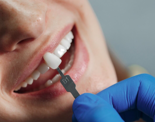 Radiant Confidence: Top Tips to Enhance Your Beautiful Smile